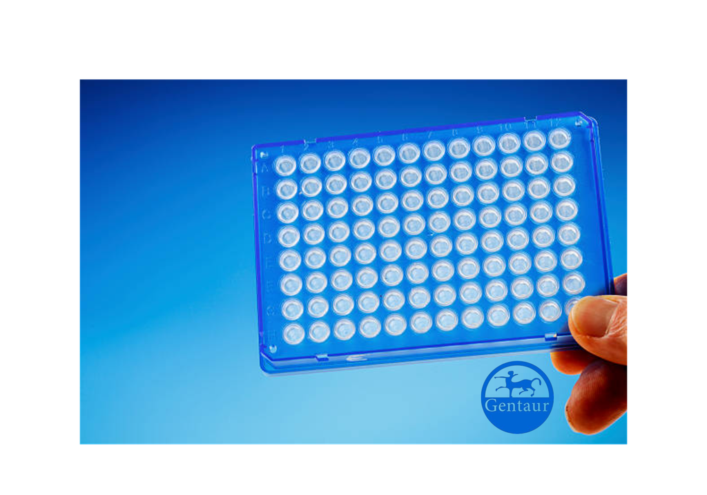 ELISA  Acetyl-TAL1|2 (Lys221|222,Lys36|37) anti-